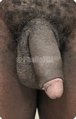 After Male Girth Enhancement 28